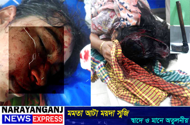বন্দরে যৌতুকের দাবিতে স্ত্রী-শ্যালিকাকে কুড়াল দিয়ে কুপিয়ে হত্যার চেষ্টা