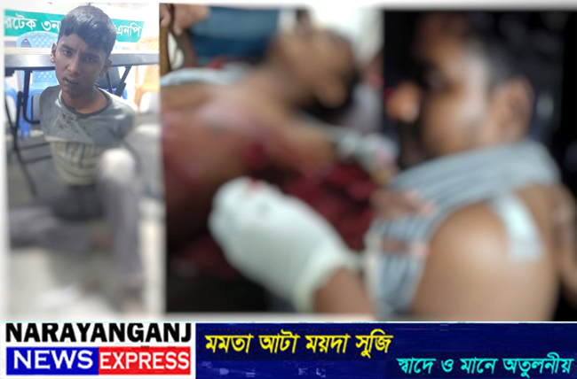 কাঁচপুরে মোবাইল চুরির অভিযোগকে কেন্দ্র করে ছুরিকাঘাতে ৫ জন আহত, আটক ১