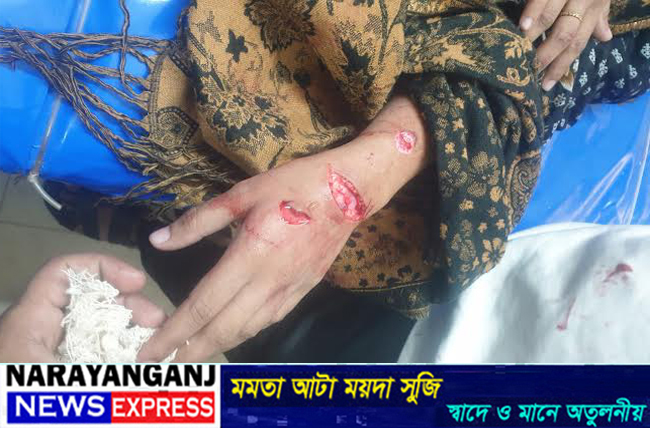 বন্দরে সাংবাদিকের কন্যাকে কুপিয়ে জখমের ঘটনায় যৌতুক লোভী শ্বাশুড়ি আটক