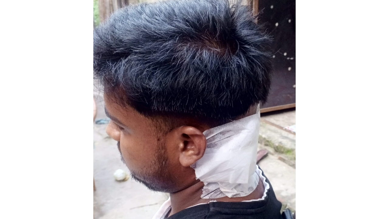 বন্দরে কলেজ ছাত্রী কে উত্ত্যক্ত করার প্রতিবাদ করায় বাবা ও ভাইকে কুপিয়ে জখম 