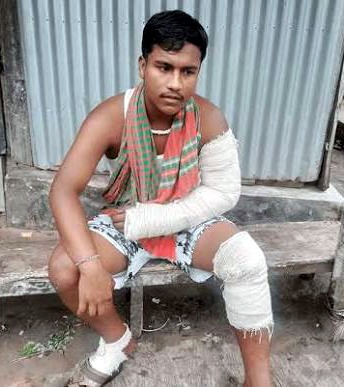 সোনারগাঁয়ে বাবা-ছেলেকে কুপিয়ে জখম
