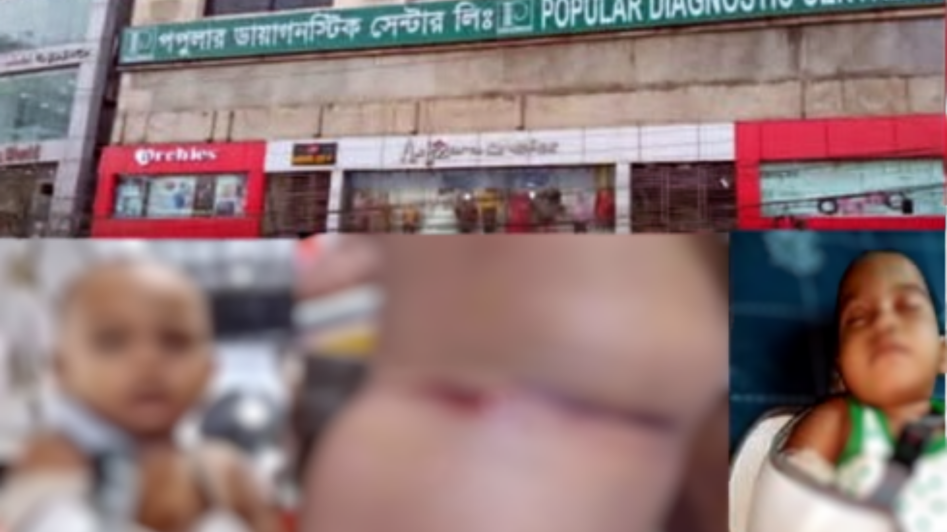 পপুলার ডায়াগনস্টিক সেন্টারের বিরুদ্ধে রক্ত সংগ্রহে অবহেলা ও অদক্ষতার অভিযোগ
